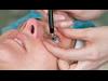 دراسة : الجراحات التجميلية للعين قد تخفف الصداع النصفى
